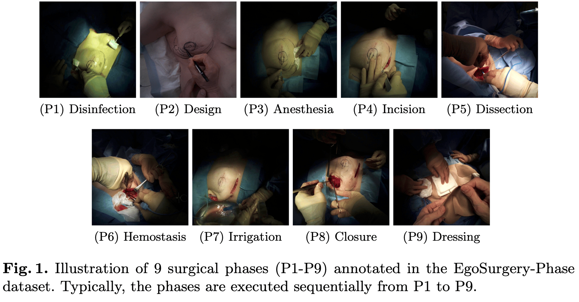 EgoSurgery official source preview.